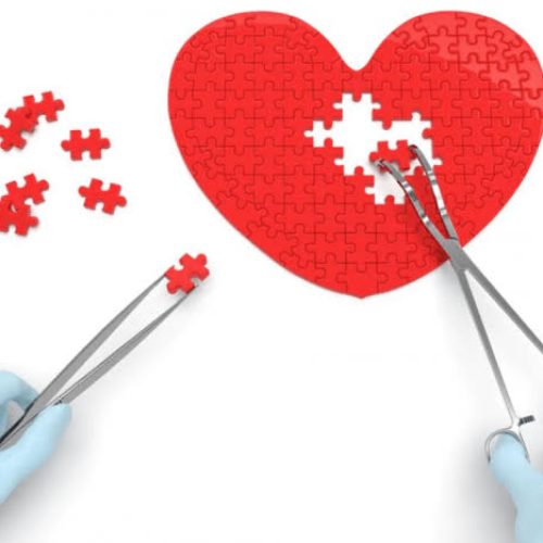 CARDIOCHIRURGIA FOTO