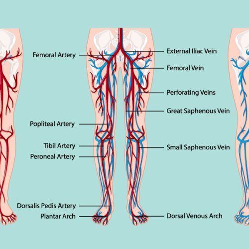 ecos-medica_Angiologia-Chirurgia-Vascolare